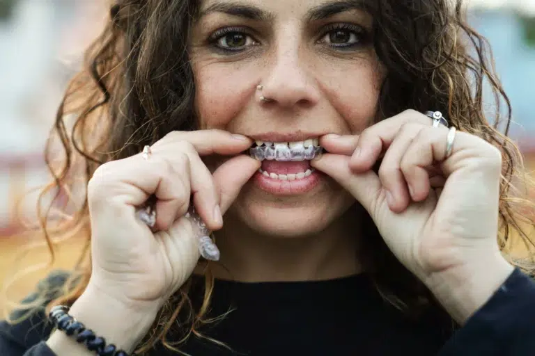 Retenedores de ortodoncia tipos, cuánto tiempo llevarlos y qué pasa si dejas de usarlos las rosas san blas madrid barbara lizaur clinica dental